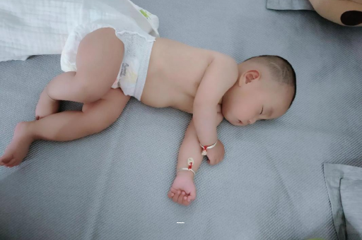 随州宝宝黄疸值多少才正常